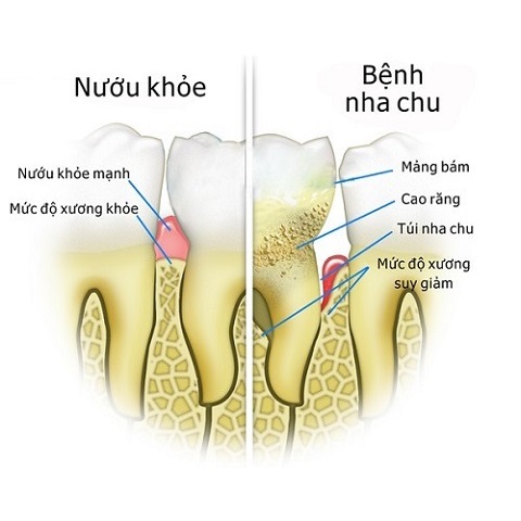 nguyen văn tùng